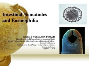 Intestinal Nematodes and Eosinophilia Patricia F Walker MD