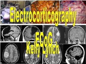 Electrocorticography or ECo G is the practice of