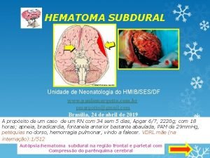 HEMATOMA SUBDURAL Unidade de Neonatologia do HMIBSESDF www