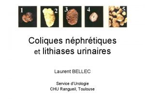 Coliques nphrtiques et lithiases urinaires Laurent BELLEC Service