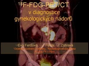 18 FFDGPETCT v diagnostice gynekologickch ndor Eva Ferdov