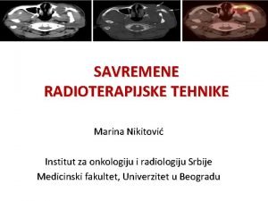 SAVREMENE RADIOTERAPIJSKE TEHNIKE Marina Nikitovi Institut za onkologiju