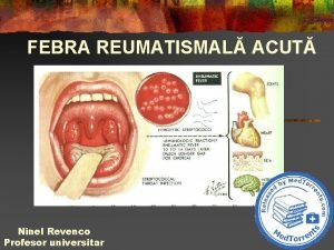 Febra reumatismala