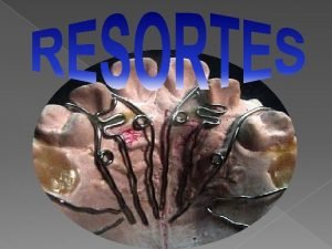 Tipos de resortes ortodoncia