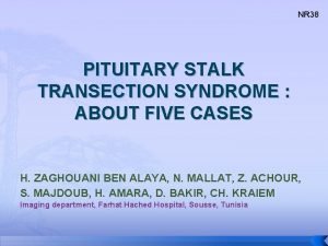 NR 38 PITUITARY STALK TRANSECTION SYNDROME ABOUT FIVE