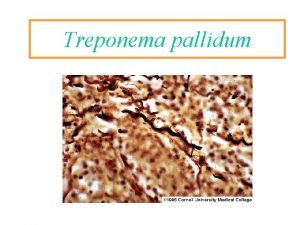 Treponema pallidum Classificazione Spirochete Spirochaetaceae Leptospiraceae Treponema pallidum