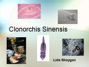 Clonorchis sinensis