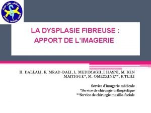 Aspect soufflé os