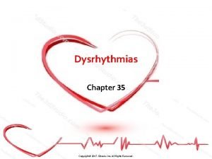 Dysrhythmias Chapter 35 Copyright 2017 Elsevier Inc All