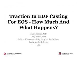 Traction In EDF Casting For EOS How Much