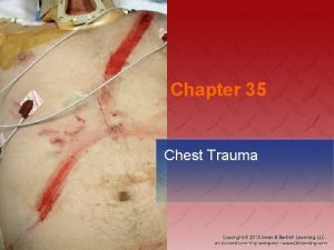 Chapter 35 Chest Trauma National EMS Education Standard