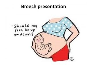 Define breech presentation