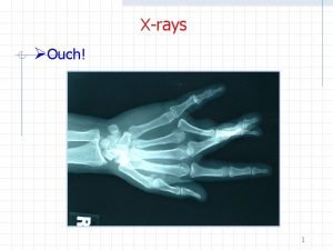 Xrays Ouch 1 Xrays Xrays are produced when