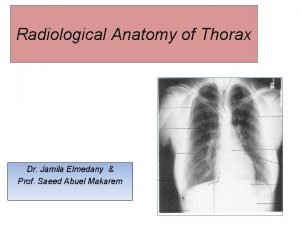 Radiological Anatomy of Thorax Dr Jamila Elmedany Prof