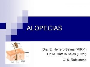 Alopecia caracteristicas