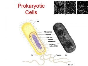 Protista prokaryotic