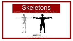 List 10 things you already know about skeletons