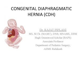 CONGENITAL DIAPHRAGMATIC HERNIA CDH Dr RAJAT PIPLANI MS
