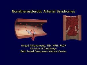 Nonatherosclerotic Arterial Syndromes Amjad Al Mahameed MD MPH