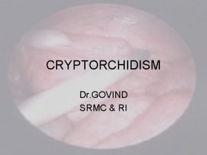 CRYPTORCHIDISM Dr GOVIND SRMC RI EMBROLOGY GONADAL RIDGE