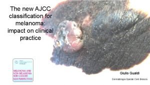 Ajcc 8 melanoma