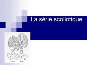 Série scoliotique