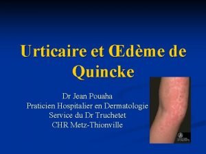 Urticaire et dme de Quincke Dr Jean Pouaha