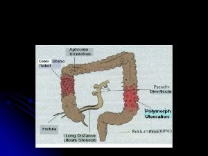 COLOSCOPY UC Early Stage l Hyperemia l Petechial