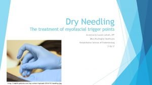 Dry Needling The treatment of myofascial trigger points