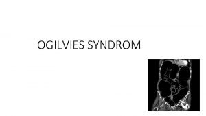 OGILVIES SYNDROM Definition Ogilvies syndrom ogs kaldet acute