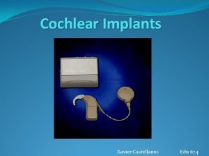 Cochlear Implants Xavier Castellanos Edu 674 About Cochlear