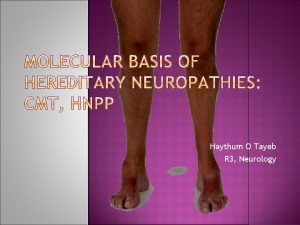Haythum O Tayeb R 3 Neurology Brief review
