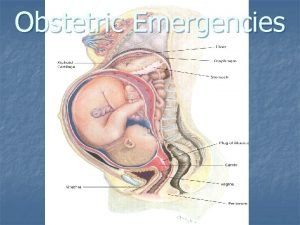 Obstetric Emergencies Obstetric Emergencies We will cover n