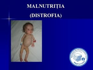 MALNUTRIIA DISTROFIA MALNUTRIIA DISTROFIA Definiie Malnutriia sau distrofia
