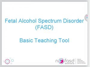 Life expectancy fetal alcohol syndrome Life expectancy fetal alcohol syndrome