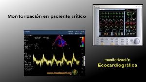 Monitorizacin en paciente crtico monitorizacin Ecocardiogrfica Ecocardiografa en