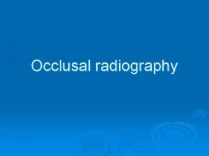 Indication of occlusal radiography