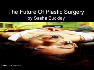 Buckley plastic surgery