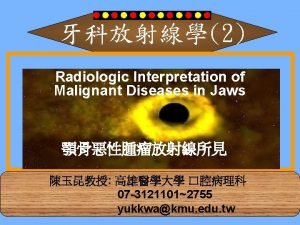 2 Radiologic Interpretation of Malignant Diseases in Jaws