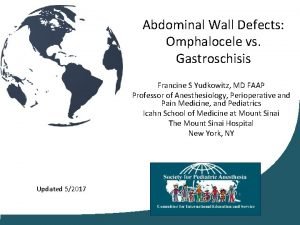 Abdominal Wall Defects Omphalocele vs Gastroschisis Francine S