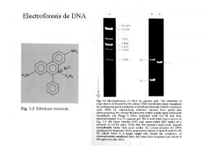 Electroforesis de DNA DNA Topoisomerasas Izquierda Derecha Enzimas