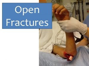 Classification of open fractures