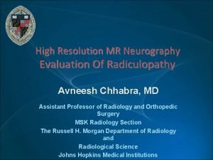 High Resolution MR Neurography Evaluation Of Radiculopathy Avneesh