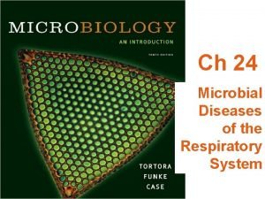 Ch 24 Microbial Diseases of the Respiratory System