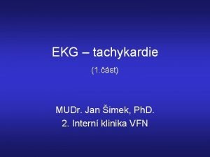 EKG tachykardie 1 st MUDr Jan imek Ph