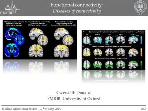 Functional connectivity Diseases of connectivity Gwenalle Douaud FMRIB Functional connectivity Diseases of connectivity Gwenalle Douaud FMRIB