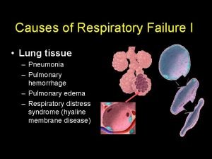 Causes of Respiratory Failure I Lung tissue Pneumonia