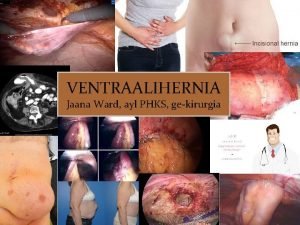 VENTRAALIHERNIA Jaana Ward ayl PHKS gekirurgia Vatsan alueen