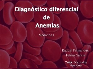 Anemia sideroblastica