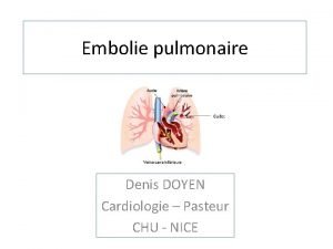 Embolie pulmonaire Denis DOYEN Cardiologie Pasteur CHU NICE